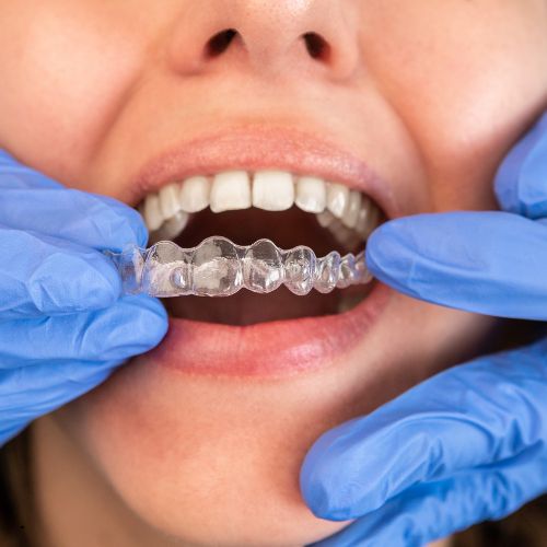 Best Dentistry in Perinthalmanna